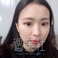 磨腮削骨恢复期到底有多长?亲身案例为你展示~