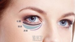 大西北祛眼袋手术术后怎么护理呢? width=