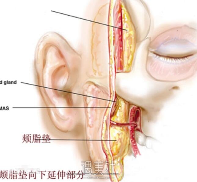 面部吸脂和去颊脂垫哪个好?傻傻的分不清!