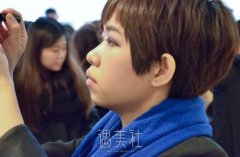 下巴后缩如何矫正：垫一个假体下巴不就行了哇 width=