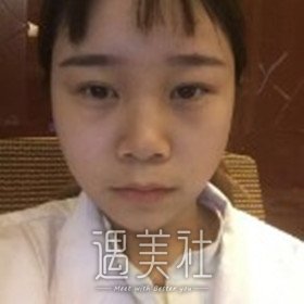 北京煤炭王驰做鼻子案例还有吗？我看网上案例这么少呢？！