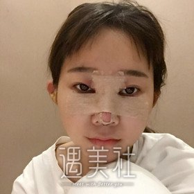 北京煤炭王驰做鼻子案例还有吗？我看网上案例这么少呢？！