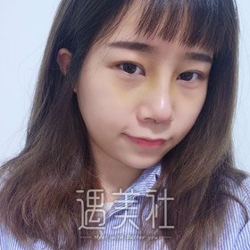 北京煤炭王驰做鼻子案例还有吗？我看网上案例这么少呢？！