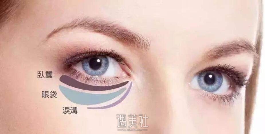 吸脂去眼袋有副作用吗?整理下吸脂去眼袋的副作用~