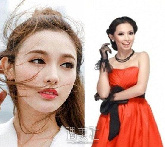 彭晓冉整容前后照片对比