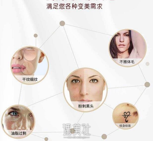 oe光子嫩肤价格
