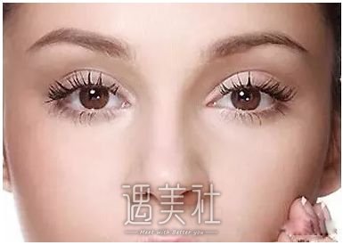 吸脂去眼袋有副作用吗?整理下吸脂去眼袋的副作用~