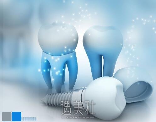 上海种植牙价格一般一颗多少钱?是不是很贵啊?
