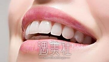 上海种植牙价格一般一颗多少钱？是不是很贵啊？