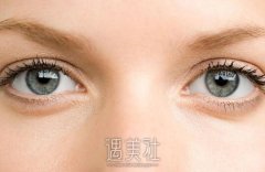 天津生物焊接双眼皮多少钱？会比其他城市贵吗？ width=