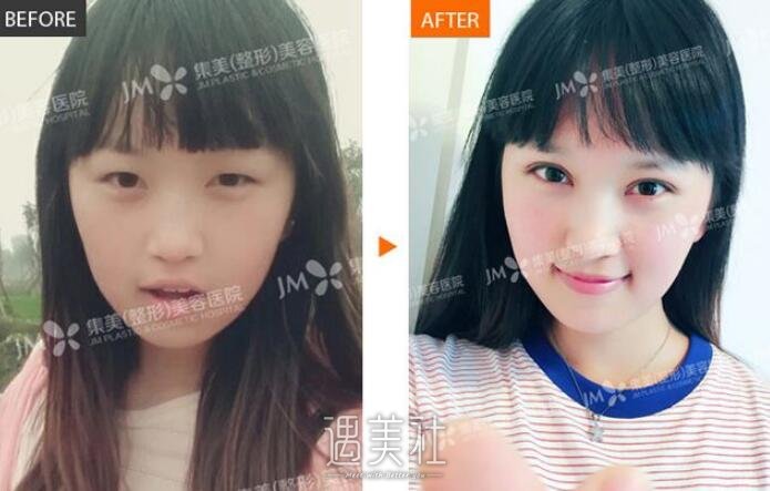 郑州集美刘德辉怎么样?一起来了解下刘医生哇~