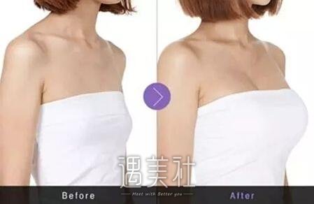 郑州集美刘德辉怎么样?一起来了解下刘医生哇~