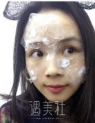 301医院陶然手术去痣案例，爱不再多一个“痣”~ width=