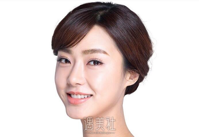 双美胶原蛋白隆鼻价格