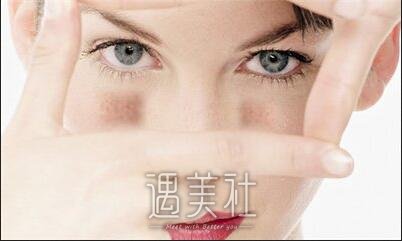 北京,复合彩光祛斑,价格一般多少