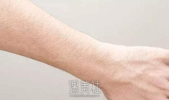手臂激光脱毛多少钱一次?没必要纠结公立私立的选择吧?