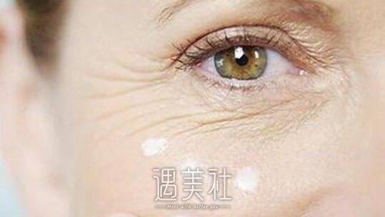 怎么样有去除鱼尾纹|去除鱼尾纹方式整理一览~