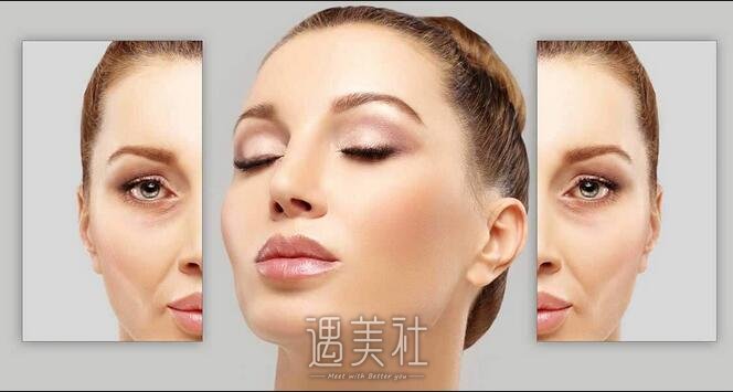 像束激光除皱是什么?像束激光除皱多方面了解下~
