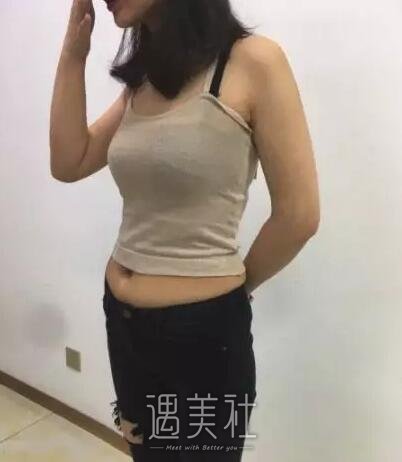 李芳整形