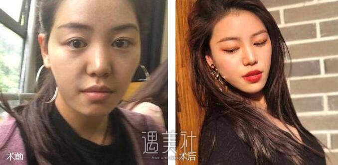 张英焕