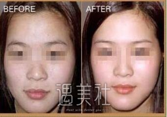 黑脸娃娃,有副作用吗