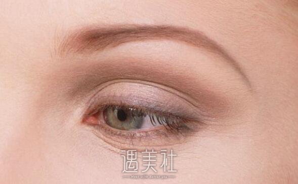 北京双眼皮多少钱?会比欧式双眼皮贵吗?