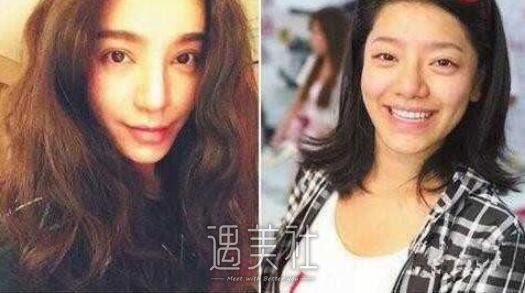 江映蓉整容前后照片曝光，都说江映蓉整容很失败!