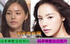闵孝琳整容前后照片分享，女神竟是这样炼成的! width=