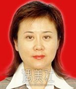 北京协和医院黄渭清双眼皮案例，不再眯眼度日~ width=