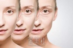 韩式除皱多少钱一次？有皱纹的我想想了解下~ width=