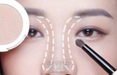 福州做开眼角塑型术大概要多少钱喃？俺想知道~ width=