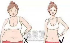 韩式共振吸脂减肥果好吗?大概能维持多久呢? width=