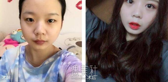 美仑整形