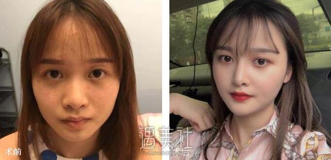 美仑整形