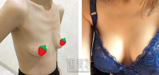 美仑整形