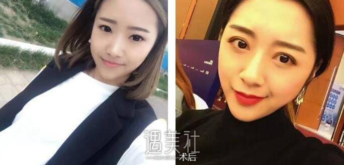 韩美整形