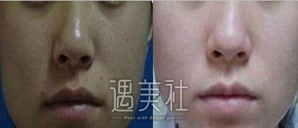 黑脸娃娃,没问题吗