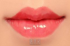 胶原蛋白丰唇没问题吗?做过的朋友帮忙回答下! width=