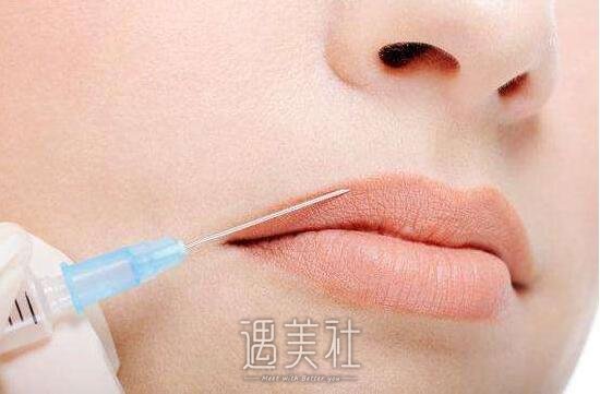 胶原蛋白丰唇没问题吗?做过的朋友帮忙回答下!