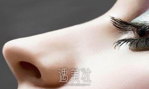 郑州鼻翼缩小手术多少钱?我的鼻翼大得夸张啊!