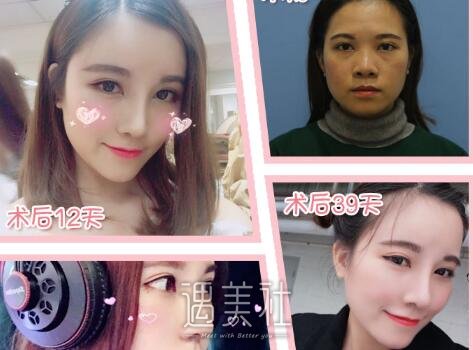 谷琪