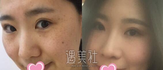澳玛星光,激光美容
