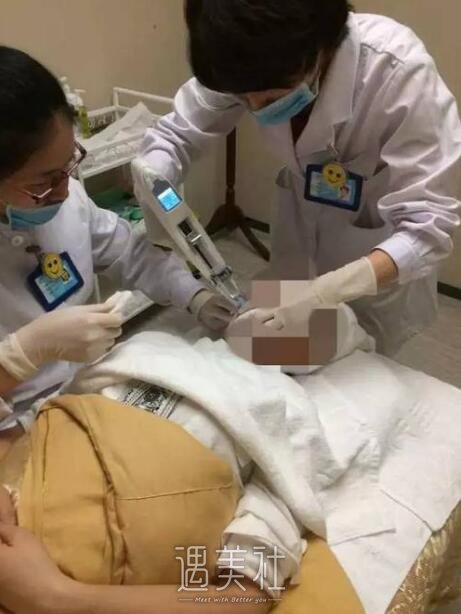 比华利林秋蓉怎么样|福州林秋蓉医生简介~