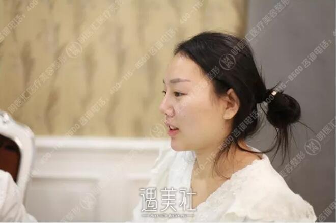 大连王艇隆鼻怎么样|王艇隆鼻案例真实分享~