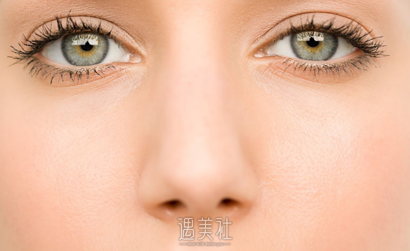 北京生物焊接双眼皮一般多少钱?收费贵吗?