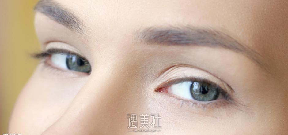 北京生物焊接双眼皮一般多少钱?收费贵吗?