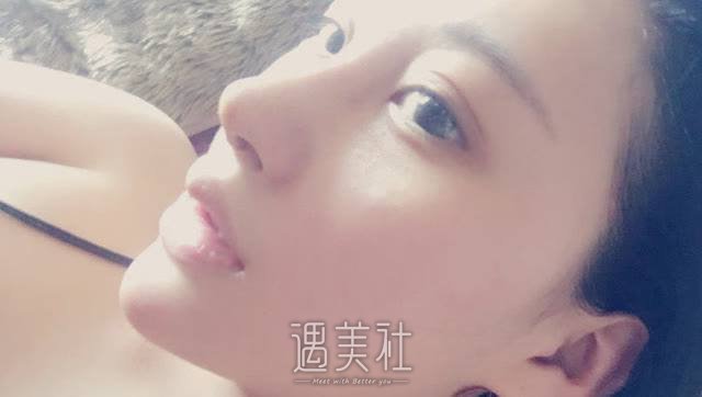 佛山肥胖下颌角整容价格贵吗?要准备多少预算?
