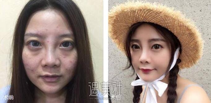 南京光尔美祛斑中心