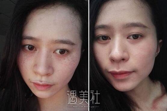 重庆真伊整形