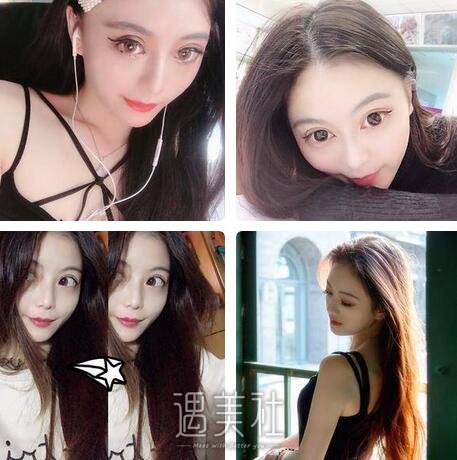 石家庄,美联臣,双眼皮